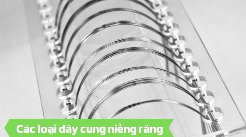 Các loại dây cung niềng răng - Nha khoa An An