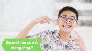 Độ tuổi nào có thể niềng răng - Nha khoa An An