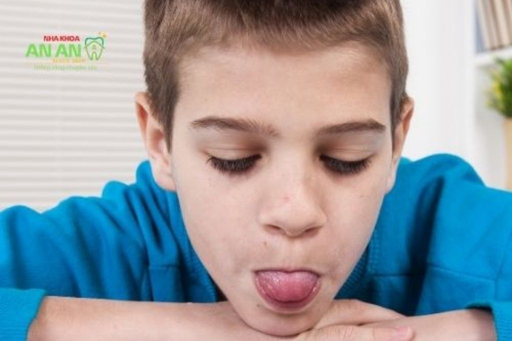 Thói quen đẩy lưỡi gây lệch lạc răng miệng