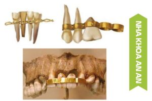 Góc chuyên môn chỉnh hình răng mặt - Nha khoa An An