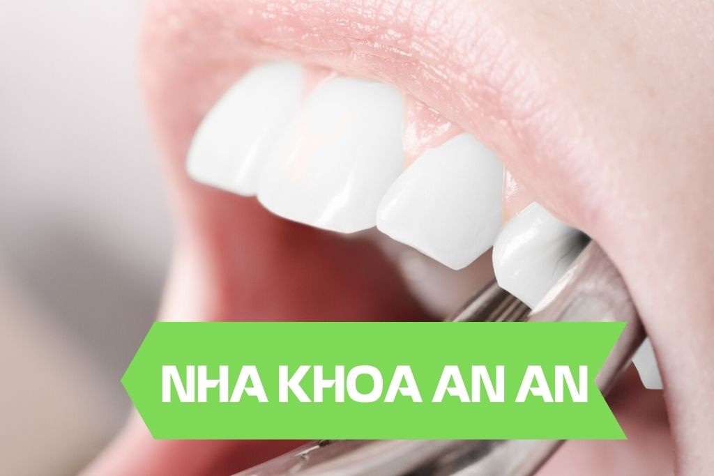 Nhổ răng hay không nhổ răng khi niềng răng