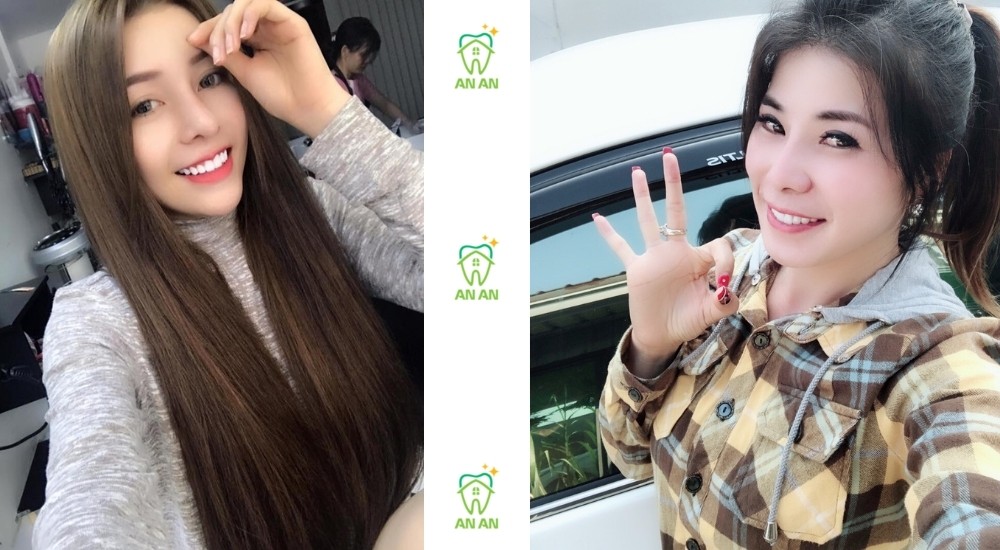 Khách hàng làm răng tại Nha khoa An An Quận 8 TP.HCM