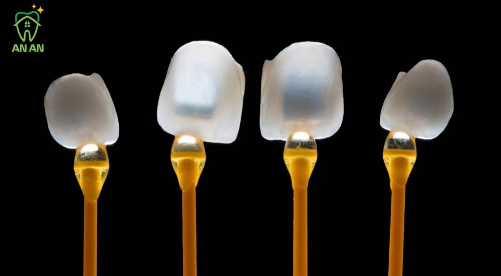 Độ mỏng của mặt dán sứ Veneer