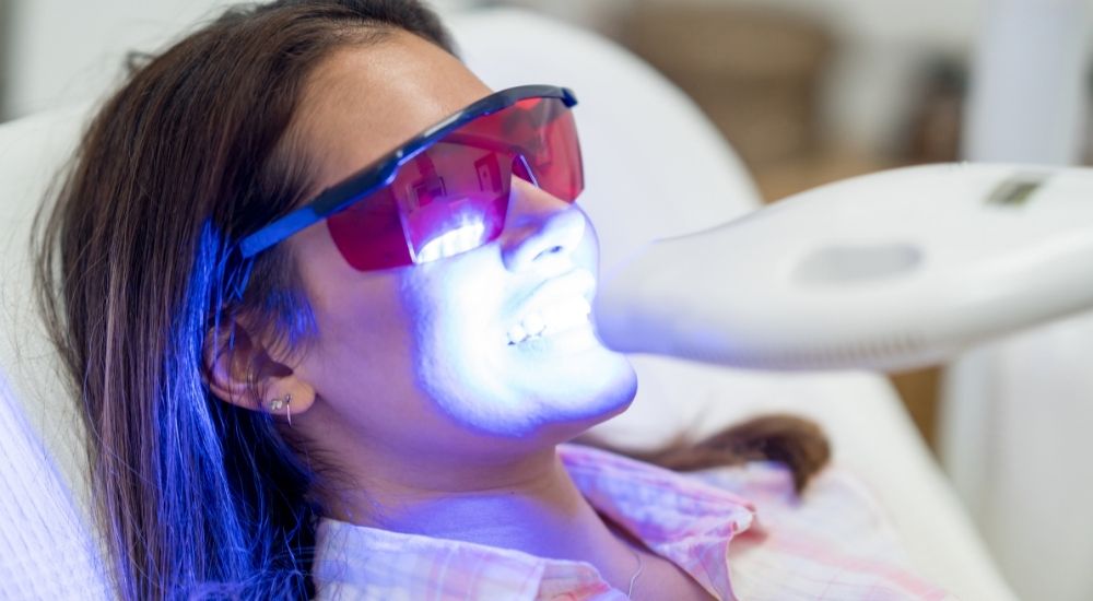 Tẩy trắng răng bằng đèn Plasma tại Nha khoa AN AN Quận 8 HCM