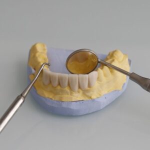 Làm răng sứ bảo hành bao lâu?