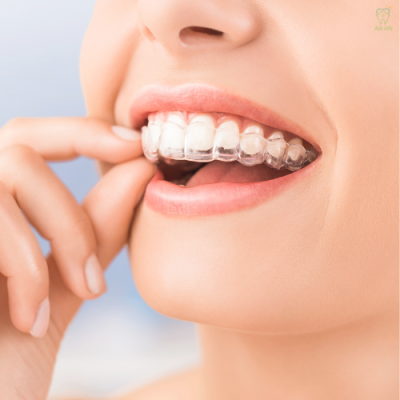 Niềng răng trong suốt tại Quận 8