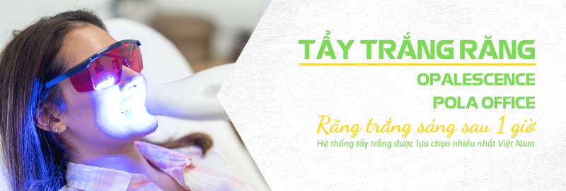 Dịch vụ tẩy trắng răng tại Nha khoa
