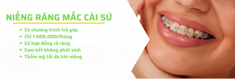 Dịch vụ niềng răng mắc cài sứ ở Nha khoa An An