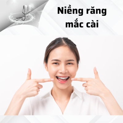 Niềng răng mắc cài