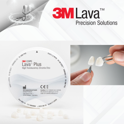 Răng sứ Lava Plus 3M có độ bền vượt trội