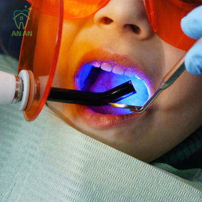 Trám răng composite bằng đèn quang trùng hợp- Dịch vụ trám răng uy tín quận 8