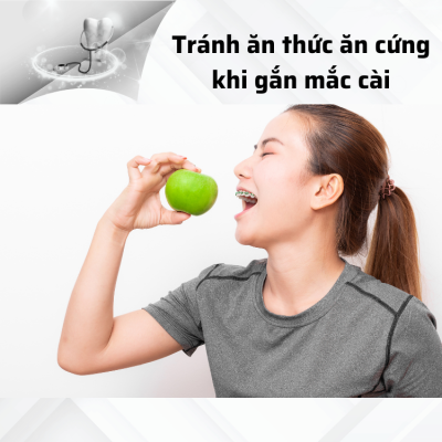 Tránh ăn thức ăn cứng khi gắn mắc cài