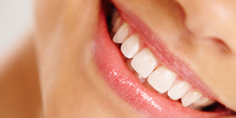 Răng sứ tự nhiên, răng sứ thẩm mỹ