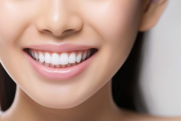 Răng sứ thẩm mỹ tại Nha khoa An An Quận 8 TPHCM