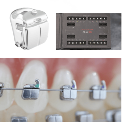 Niềng Răng Mắc Cài Kim Loại Tự Khoá 4 Cấu tạo mắc cài kim loại tự khoá