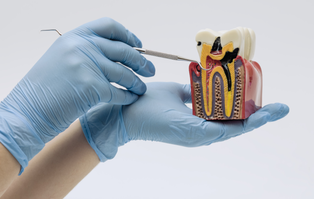 Ảnh mô tả tủy răng