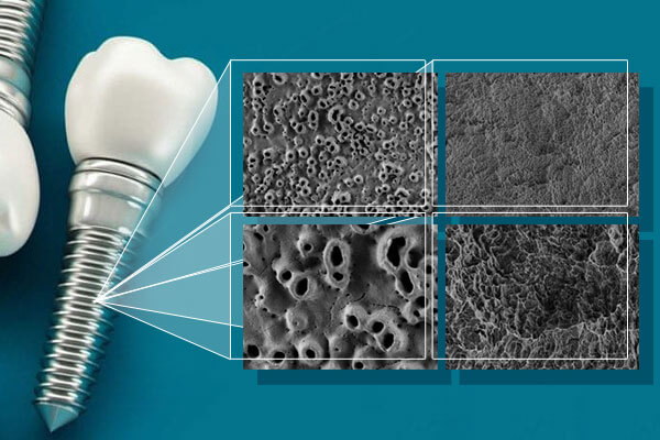 Bề mặt của implant nha khoa
