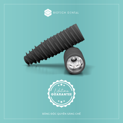 Implant Kontact