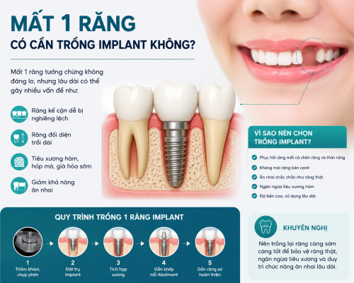 Ảnh mô tả mất răng trồng implant