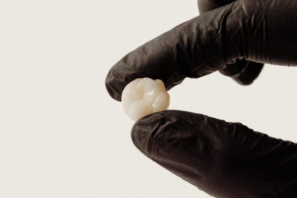 Bọc răng sứ giữ được bao lâu? Bí quyết giúp răng sứ bền đẹp 15–20 năm 3 Ảnh răng sứ sau khi hoàn thiện