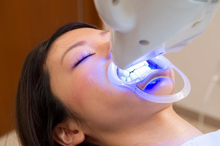 Nha Khoa Tẩy Trắng Răng Uy Tín – Bí Quyết Sở Hữu Hàm Răng Trắng Sáng An Toàn 1 Khách tẩy trắng răng tại nha khoa