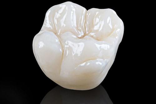 Bọc răng sứ giữ được bao lâu? Bí quyết giúp răng sứ bền đẹp 15–20 năm 4 Ảnh 1 răng cối làm từ sứ Zirconia