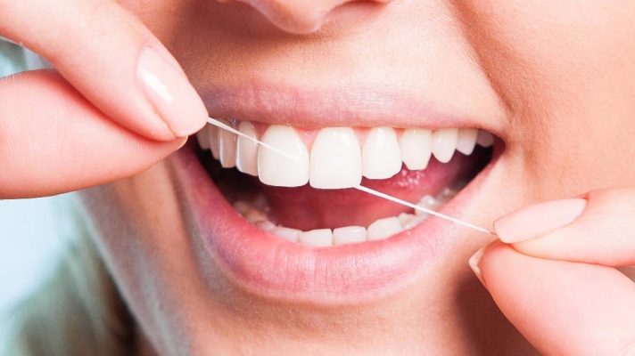 Bọc răng sứ giữ được bao lâu? Bí quyết giúp răng sứ bền đẹp 15–20 năm 6 Răng sứ giữ được bao lâu? - Vệ sinh răng sứ bằng chỉ nha khoa