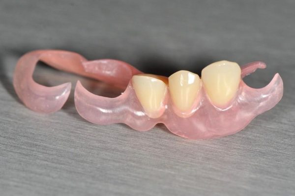 Hàm nhựa dẽo và móc dẽo