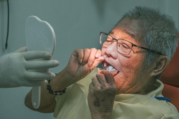 Khách hàng thử răng tháo lắp