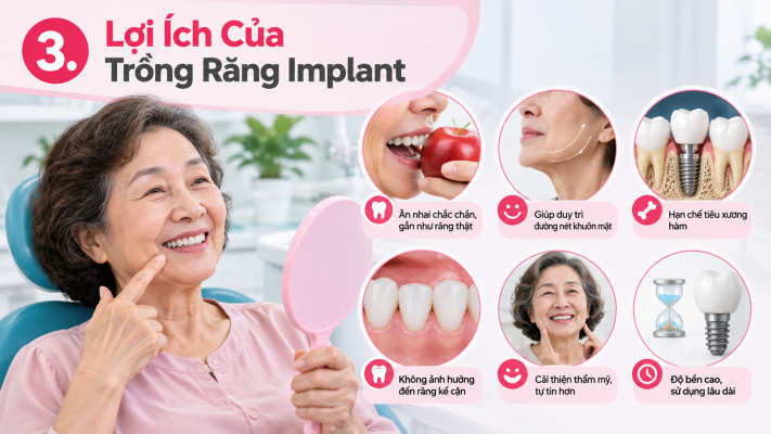3 Lợi ích của trồng răng Implant - Trồng răng cấy ghép implant HCM Quận 8 - Nha khoa An An