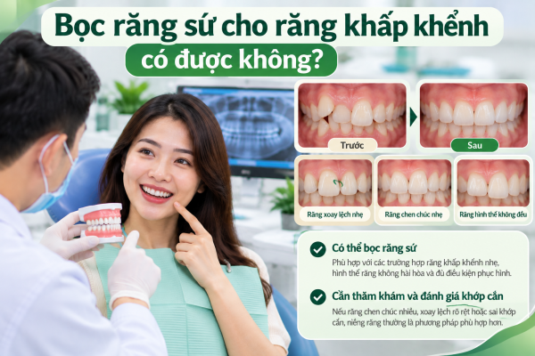 Bọc răng sứ cho răng khấp khểnh