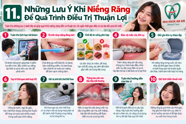 Cẩm Nang 10 Lưu Ý Khi Niềng Răng