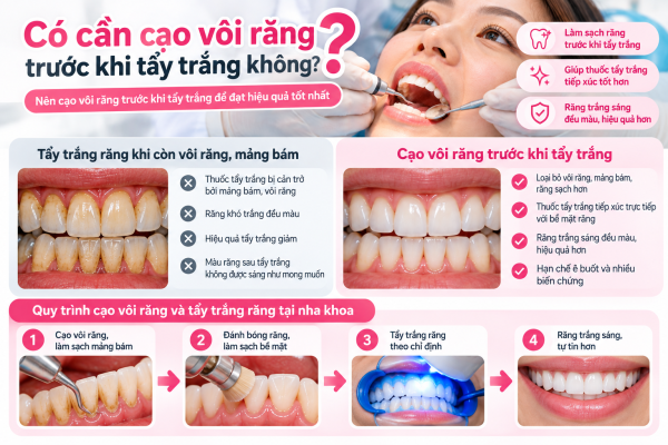 Cạo Vôi Răng Quận 8 Giá Bao Nhiêu? Bảng Giá Nha Khoa An An 7 Cạo vôi răng quận 8 giá bao nhiêu? Cạo vôi trước khi tẩy trắng răng