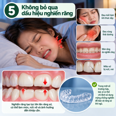 7 Cách Chăm Sóc Răng Sứ Bền Lâu 6 Dấu hiệu nghiến răng khi ngủ - Chăm sóc răng sứ sau khi bọc