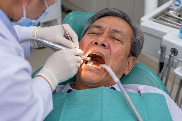 Điều trị răng trong phòng khám hiện đại -Bọc răng sứ mấy răng là đẹp, 6-8-hay10