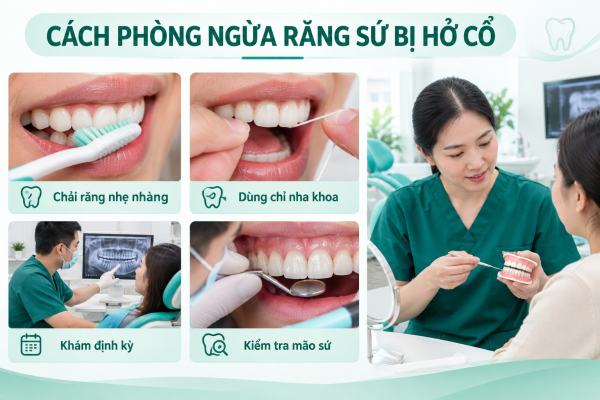Hướng Dẫn Phòng Ngừa Răng Sứ Hở Cổ