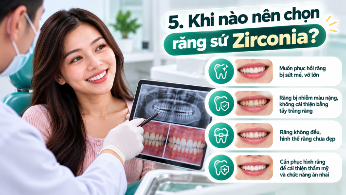 Răng Sứ Zirconia: 5 Ưu Nhược Điểm Và Giá 6 Khi nào nên chọn răng sứ Zirconia_