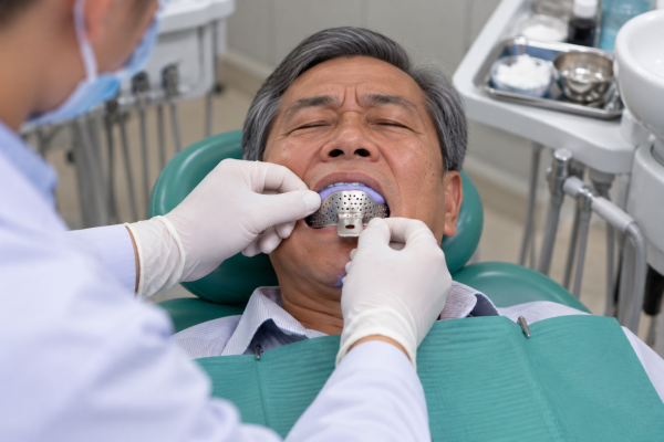 Lấy dấu răng trong phòng khám nha khoa - Bọc răng sứ mấy răng là đẹp, 6-8-hay10