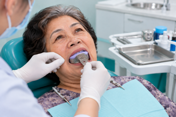 Lấy dấu răng trong phòng nha khoa _ Bọc răng sứ có hại không