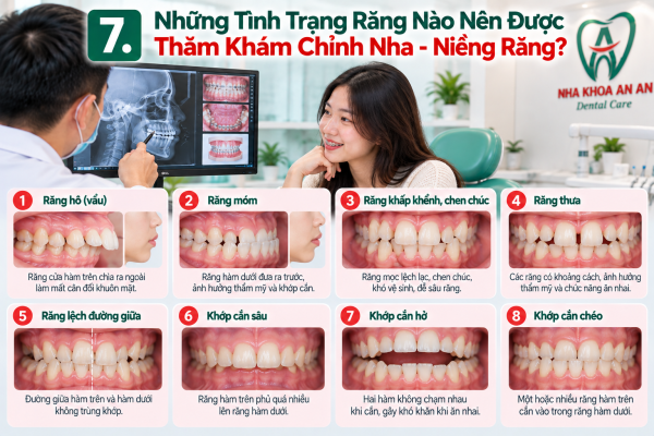 Những Tình trạng răng nên chỉnh nha -niềng răng
