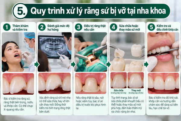 Răng Sứ Bị Vỡ: 5 Cách Xử Lý Và Khi Nào Cần Thay Mới? 6 Quy trình xử lý răng sứ bị vỡ