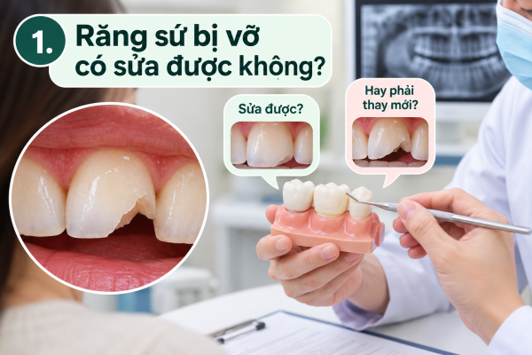 Răng Sứ Bị Vỡ: 5 Cách Xử Lý Và Khi Nào Cần Thay Mới? 2 Răng sứ bị vỡ_ Sửa hay thay mới_