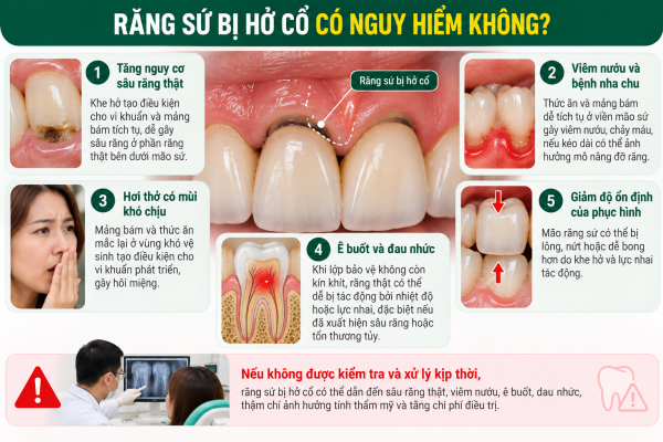 Răng sứ hở cổ_ Nguy cơ nha khoa