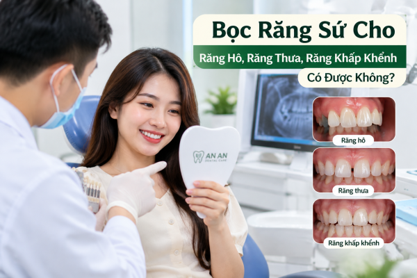 Tư vấn bọc răng sứ cho răng hô, thưa, khấp khểnh tại nha khoa