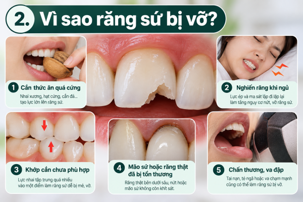 Răng Sứ Bị Vỡ: 5 Cách Xử Lý Và Khi Nào Cần Thay Mới? 3 Vì Sao Răng Sứ Bị Vỡ_