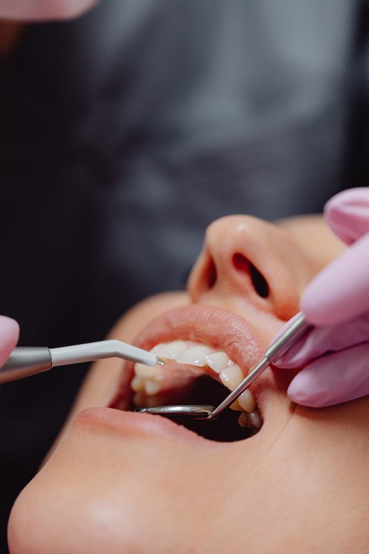 Cạo Vôi Răng Quận 8 Giá Bao Nhiêu? Bảng Giá Nha Khoa An An 1 Cạo vôi răng quận 8 giá bao nhiêu?